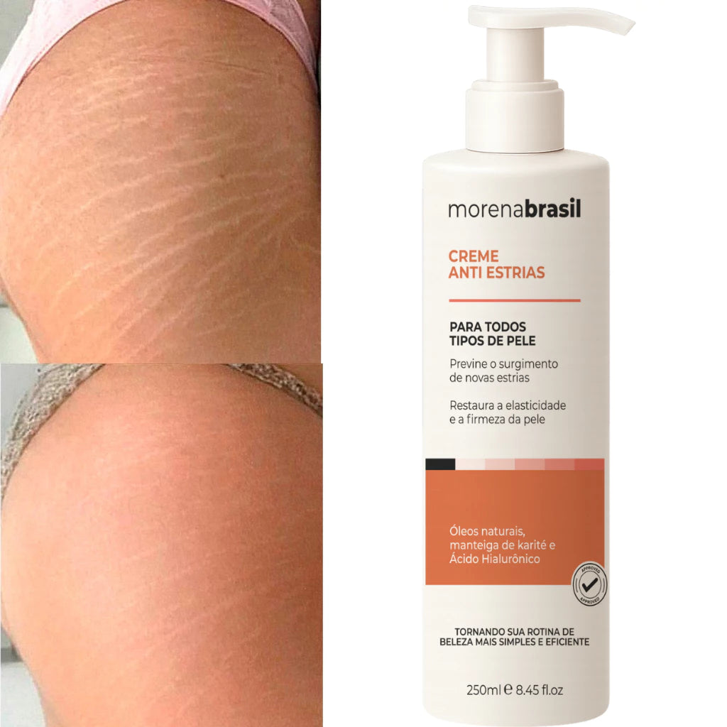 Kit Creme Anti Estrias + Anti Flacidez
